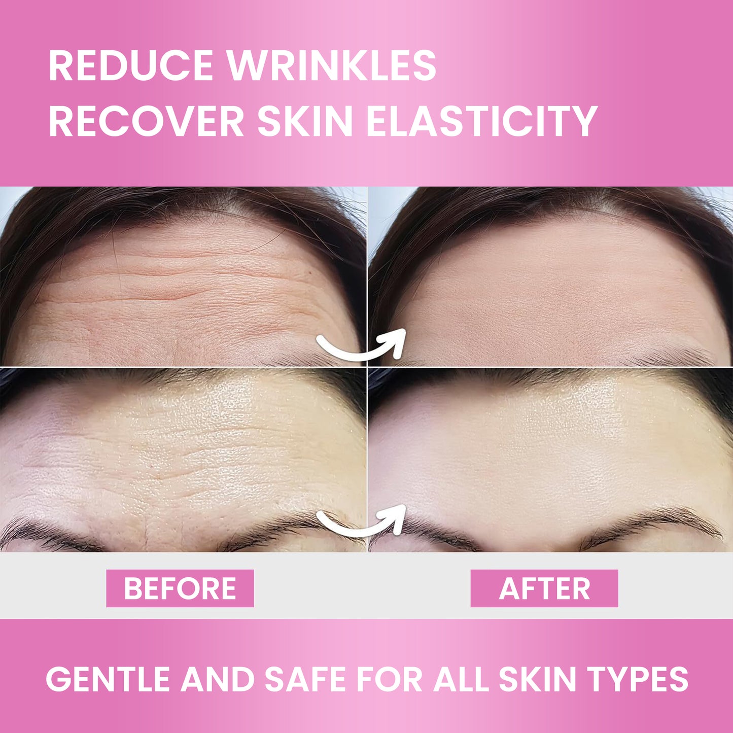 Forehead Wrinkle Patches